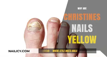 Why Christine's Nails Are Yellow: Causes, Prevention, and Solutions