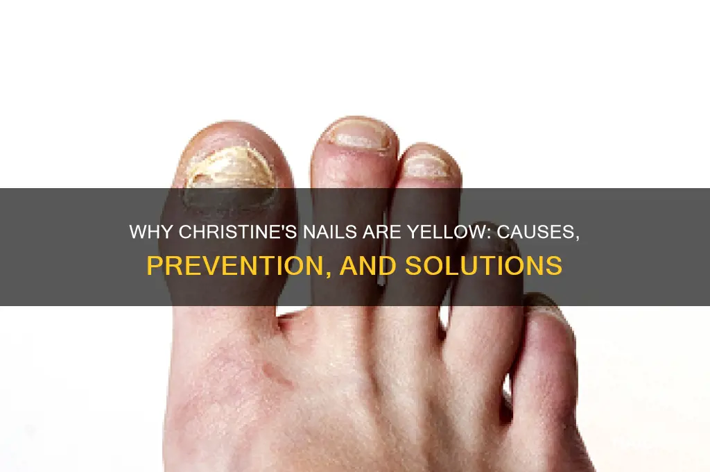 why are christines nails yellow