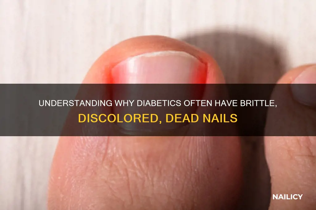 why are diabetics nails dead
