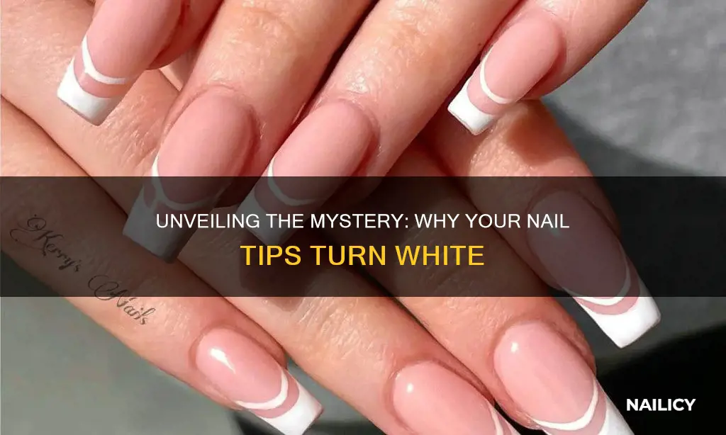 why are finger nail tips white