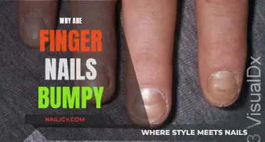 Unraveling the Mystery: Why Your Fingernails Have Bumps