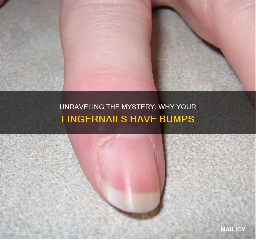 why are finger nails bumpy