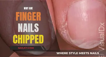 Unraveling the Mystery: Why Do Finger Nails Chip?