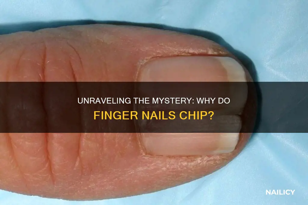 why are finger nails chipped