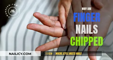 The Mystery of Chipped Nails: What's the Deal?