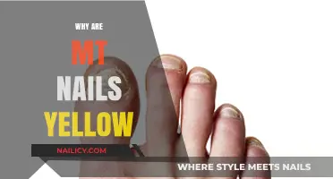 Why Are My Nails Yellow? Causes and Solutions Explained