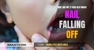 Toddler Fingernail Loss: What Parents Should Know