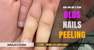 Toddler Nail Peeling: Causes and Solutions for Healthy Growth