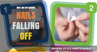 Why Are My Baby's Nails Falling Off? Causes and Solutions