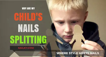 Why Are My Child's Nails Splitting? Causes and Solutions