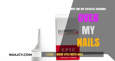 Cuticles Overgrowing Nails: What's the Cause?