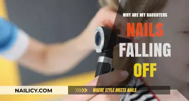 Why Are My Daughter's Nails Falling Off? Causes and Solutions