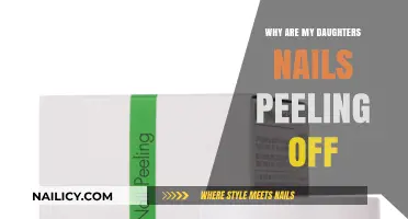 Why Are My Daughter's Nails Peeling? Causes and Solutions