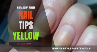 Yellow Nail Tips: Understanding the Cause and Solutions