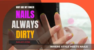 Dirty Fingernails: A Constant Battle for Cleanliness