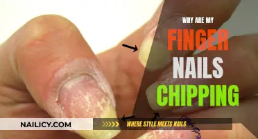 Chipped Nails: Understanding the Causes and Solutions