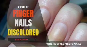 Unraveling the Mystery: Why Are Your Finger Nails Discolored?