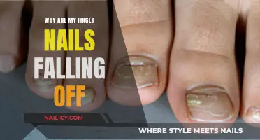 Nail Loss: Understanding the Causes and Seeking Solutions