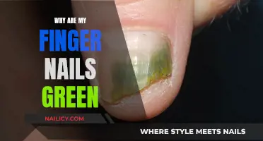 The Mystery of Green Fingernails: Causes and Cures