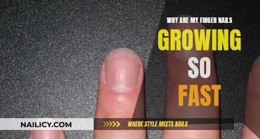 Unusual Nail Growth: Understanding the Factors Behind Your Fast-Growing Nails