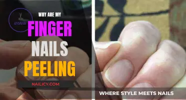 Unraveling the Mystery: Why Are My Finger Nails Peeling?