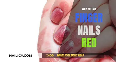 Red Nails: Understanding the Possible Causes and When to Seek Help