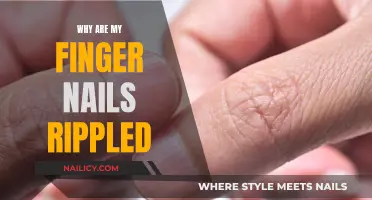 Unraveling the Mystery: Why Your Nails Have Ripple-like Patterns