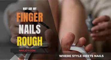 Rough Fingernails: Causes and Remedies for Uneven Nail Texture