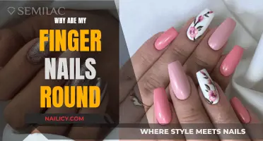 Unusual Nail Shape: Understanding Rounded Fingernails