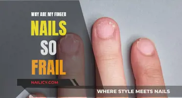 Fragile Fingernails: Understanding the Causes and Solutions