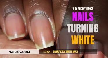 Unraveling the Mystery: Why Are My Finger Nails Turning White?