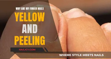 Yellow, Peeling Nails: Causes and Solutions