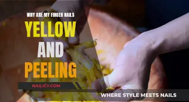 Yellow, Peeling Nails: What's the Cause and How to Treat?