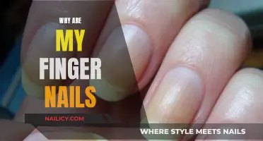 Yellow, Brittle, and Peeling: Understanding Nail Health