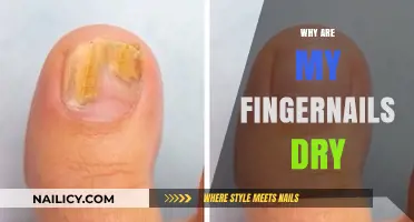 Dry Fingernails Explained: Causes, Prevention, and Effective Remedies