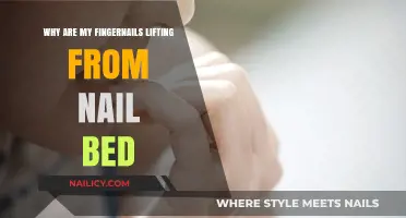 Fingernails Lifting from Nail Bed: Causes and Solutions Explained