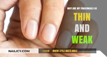 Why Are My Fingernails So Thin and Weak? Causes and Solutions