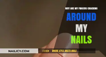 Why Do My Fingers Crack Around the Nails? Explained
