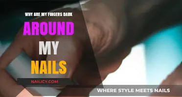 Dark Fingers Around Nails: Causes and Solutions Explained