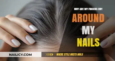 Dry Skin Around Nails: Causes, Prevention, and Effective Remedies