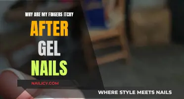 Gel Nails Itch: What's the Real Deal?