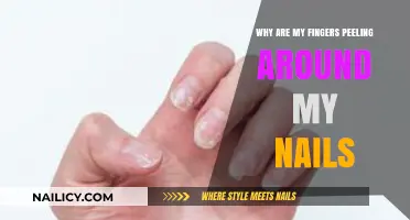 Why Are My Fingers Peeling Around My Nails? Causes and Solutions