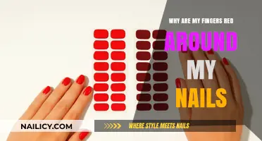 Red Fingers Around Nails: Causes, Concerns, and Remedies Explained