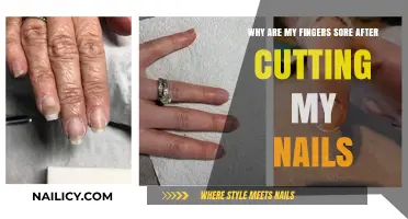 Finger Pain: Post-Trim Tenderness Explained