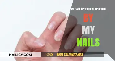 Why Are My Fingers Splitting Near My Nails? Causes and Solutions