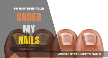 Yellow Fingernail Discoloration: Causes and Solutions for Healthy Nails