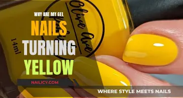 Gel Nails Turning Yellow: What's the Deal?