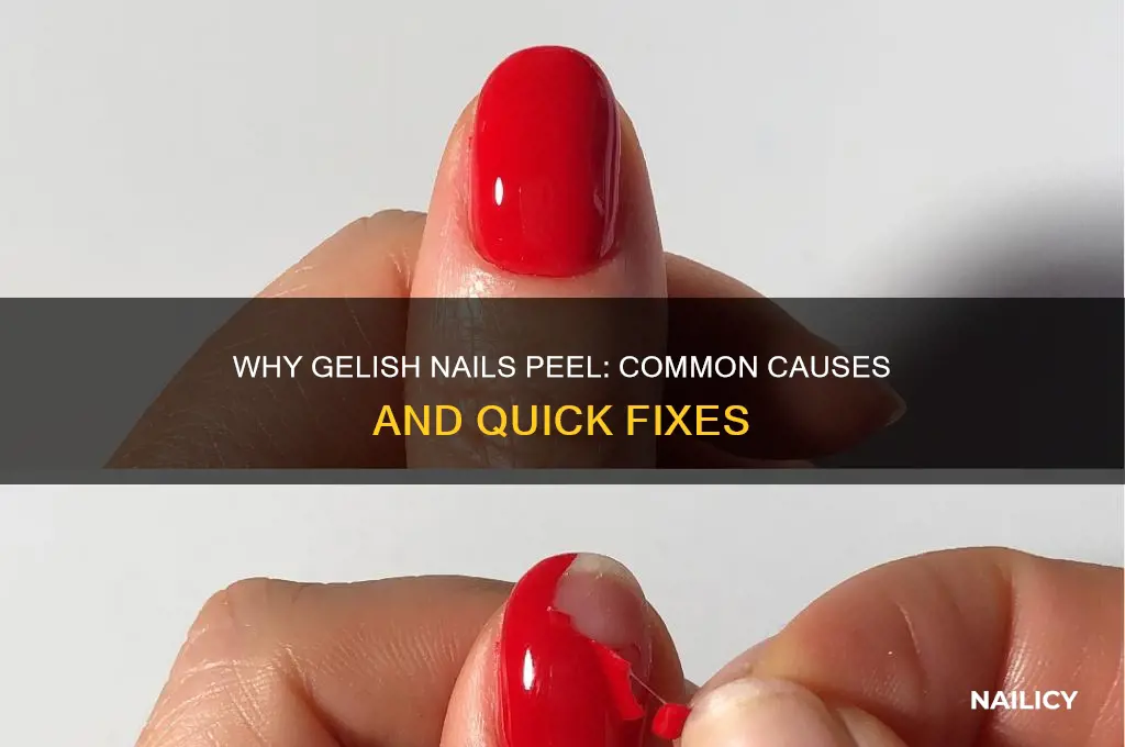 why are my gelish nails peeling off
