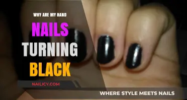 Black Hand Nails: Causes, Concerns, and When to Seek Help