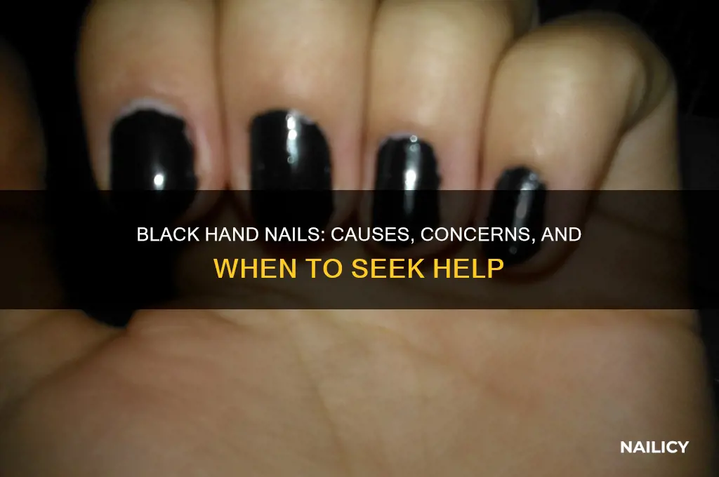 why are my hand nails turning black
